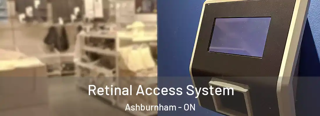  Retinal Access System Ashburnham - ON